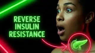 Reverse Insulin Resistance in Months, Not Years (The Protocol)