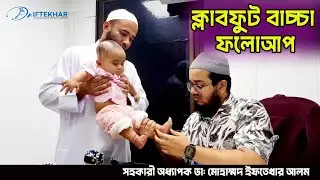 ক্লাবফুট বাচ্চা সম্পূর্ণ সুস্থ | Clubfoot Treatment by Dr.Iftekhar Alam #clubfoot #health #doctor