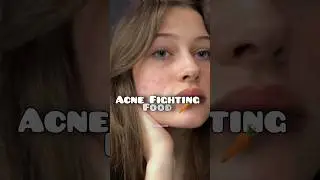 🍓Acne Fighting Food 💗✨#acne #acneremoval #food #acnetreatment #aesthetic #beautytips#ytshorts#shorts