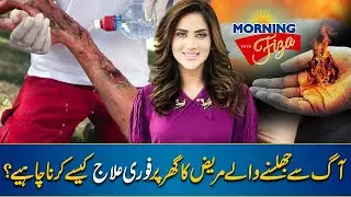 How to Treatment Burn Skin at Home - Easy Tips to Use Hot Water Burn Injury - Morning With Fiza