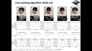 Revolutionizing Healthcare with Wearable Ultrasound Technology