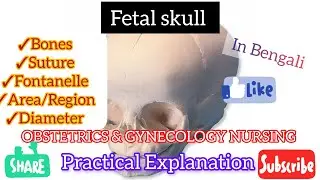 Fetal Skull |Bone|Suture|Fontanelle|Area|Diameter| practical Explanation|OBG Lecture in Bengali 2025