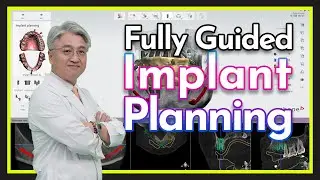 [DIGITAL DENTISTRY] Fully Guided Implant Planning Using Implant Studio SW