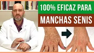 Manchas Senis nas M&Atilde;OS e no ROSTO? [ ESSE &Eacute; GARANTIDO ] Como tirar estas manchas escuras da pele