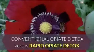 Conventional vs Rapid Opioid Detoxification - Michigan Addiction Center PLLC (800) 458-8130