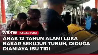 Dianiaya Ibu Tiri, Anak di Sukabumi Meninggal Dunia Akibat Luka Bakar | Kabar Pagi