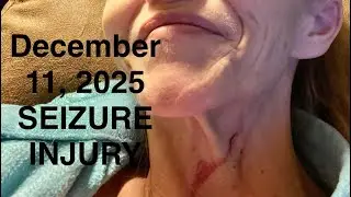 Tonic Clonic, Grand Mal EPILEPSY SEIZURE INJURY tonight 12/11/2025. 
