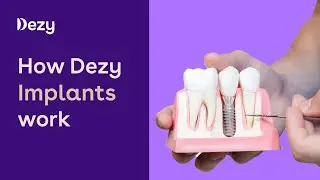 How Dezy Implants Work?