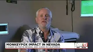 Monkeypox precautions urged as Nevada cases remain low, numbers surge in California