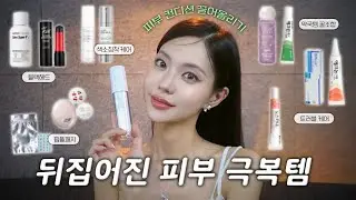 ⚠️역대급으로 피부가 뒤집어졌다면 이 영상을 보시오⚠️피부 원상복구 소생시키기! 나만의 비밀병기들 전부 알려드려용!!💡(Eng)