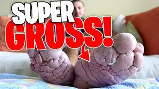 My Feet are Killing Me: The GROSSEST Moments of 2021! SUPER GROSS! (Part 7)
