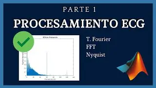PRE-PROCESAMIENTO ECG 2022 MATLAB | Transformada de Fourier | Parte 2