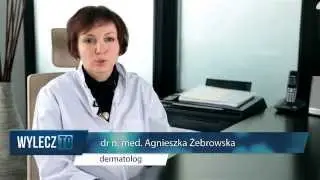 Toczeń rumieniowaty