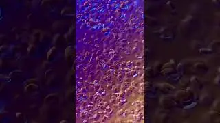 What Human Blood REALLY Looks Like Under A Microscope