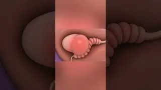 Epididymitis: Inflammation Behind the Testicle