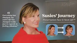 Susie's Preservation Facelift Recovery with Elixir MD