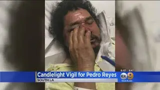 Vigil Held For Beaten LA Street Vendor, Highlighting Demand For Vending Legalization