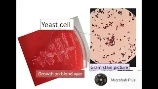 Yeast cell grown on blood agar| yeast cells microscopy |yeast cell gram staining