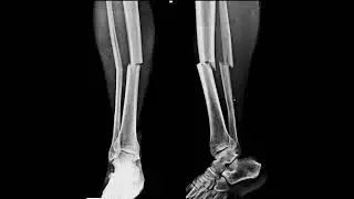 ..#xray #radiologystudent #ctscan #radiology #mritechnologist #nursingschool #viral #trending #video
