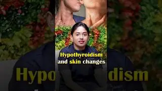 Hypothyroidism Symptoms: Skin Dryness & Hair Breakage #Hypothyroidism #skinchanges #skincaretips