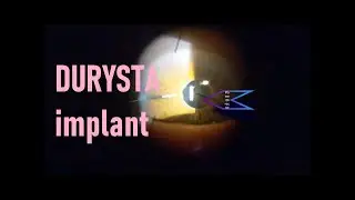 How to Durysta: Durysta Intracameral Implant for Glaucoma (MIGS)
