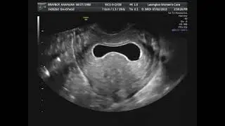 Lady Claire's Ultrasound