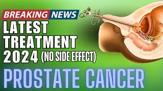 0% SIDE EFFECTS - LATEST PROSTATE CANCER TREATMENT 2024