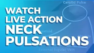 Pulsations in the Neck | MedStudy's Heart Sounds