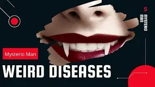 Weird  diseases/disorders(vampire disease) , अजीब विकार,रोग, physcological disease, मनोवैज्ञानिक रोग