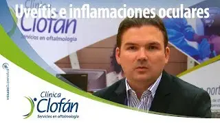 Uveítis e inflamaciones oculares - Dr.  Miguel Cuevas