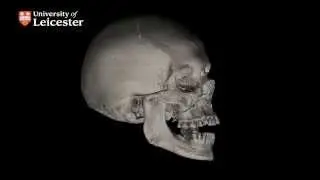 micro-CT Scan of Richard III's Skull