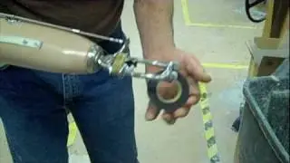 Trans-Radial Amputee