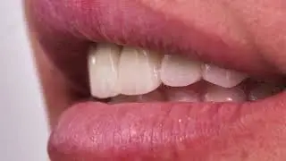 Sorriso che incanta