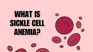 The Genetic Challenges of Sickle Cell Disease