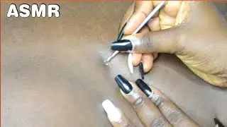 ASMR Upclose ATTENTIVE Back Nitpicking With Tools | Triggers For Sleep 😴