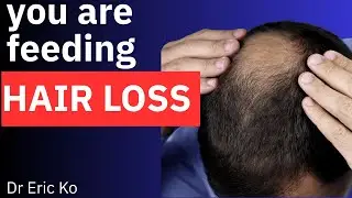 Foods that feed HAIR LOSS