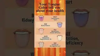 Your Tongue tell you about your Health #shorts #ytshorts #health #tongue