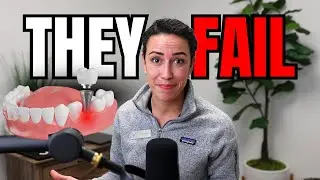 99% of People Don't Know This About Dental Implants
