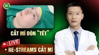 Mắt Đẹp Sau Cắt M&iacute; - Kết Quả Bất Ngờ!