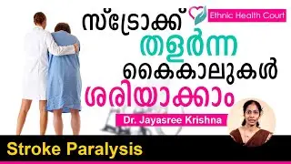 Recover from Stroke Paralysis | സ്ട്രോക്ക് വന്ന് തളർന്ന കൈകാലുകൾ ശരിയാക്കാം | Ethnic Health Court