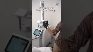 Pico Laser Treatment for Pigmentation and Acne Marks | Zenderma