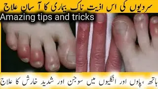 Useful Kitchen Hacks | Kitchen Organization Hacks | Cleaning Tricks Viral Kitchen Tips #cookingtips 