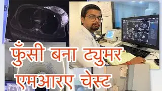 MRI CHEST/ Radiology.master by राजीव रंजन #igims 