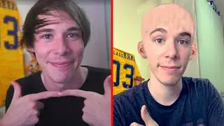 Así Folagor perdió su pelo.