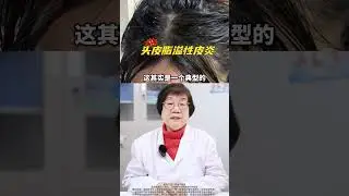 头皮已经成了真菌的培养皿了！脂溢性皮炎 头皮屑多 抖出健康知识宝藏  医学科普 去屑
