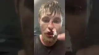 Bryce Mitchell&rsquo;s Nose vs Dana White&rsquo;s Healthcare Plan 😂 (MMA Reality Check)
