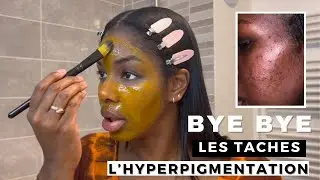 MASQUE MAISON CONTRE LES TACHES ET L&rsquo;HYPERPIGMENTATION: LE MEILLEUR REM&Egrave;DE NATUREL !