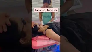 Smooth skin. Long-lasting results.💫#LaserHairReduction #SkinCare #SelfCare #HealthySkin #GlowingSkin