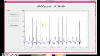 Matlab GUI - image processing (ECG)