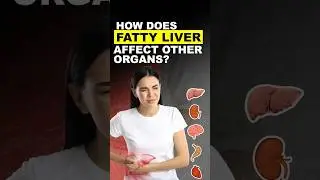 Fatty Liver Affects More Than Just Your Liver | Hidden Dangers No One Talks About!